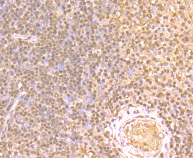 Immunohistochemical analysis of paraffin-embedded human tonsil tissue using anti-GAPDH antibody. Counter stained with hematoxylin.