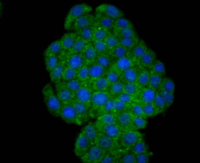 ICC staining TrkA in PC-12 cells (green). The nuclear counter stain is DAPI (blue). Cells were fixed in paraformaldehyde, permeabilised with 0.25% Triton X100/PBS.