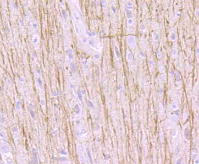 Immunohistochemical analysis of paraffin-embedded rat brain tissue using anti-TrkA antibody. Counter stained with hematoxylin.