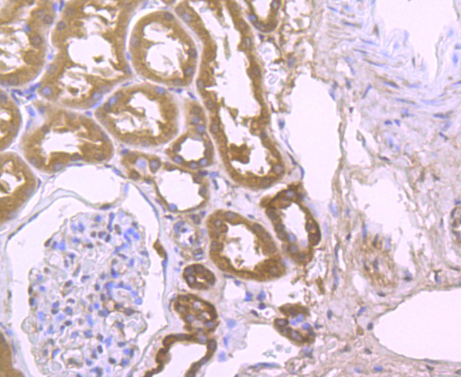 Immunohistochemical analysis of paraffin-embedded human kidney tissue using anti-PLGF antibody. Counter stained with hematoxylin.