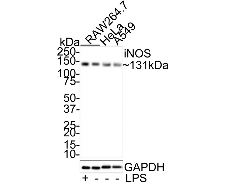 Western blot analysis of iNOS on A549 cell lysates with Rabbit anti-iNOS antibody (ER1706-89) at 1/500 dilution.<br />
<br />
Lysates/proteins at 10 µg/Lane.<br />
<br />
Predicted band size: 131 kDa<br />
Observed band size: 131 kDa<br />
<br />
Exposure time: 2 minutes;<br />
<br />
6% SDS-PAGE gel.<br />
<br />
Proteins were transferred to a PVDF membrane and blocked with 5% NFDM/TBST for 1 hour at room temperature. The primary antibody (ER1706-89) at 1/500 dilution was used in 5% NFDM/TBST at room temperature for 2 hours. Goat Anti-Rabbit IgG - HRP Secondary Antibody (HA1001) at 1:300,000 dilution was used for 1 hour at room temperature.