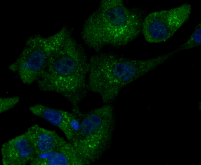 ICC staining iNOS in LOVO cells (green). The nuclear counter stain is DAPI (blue). Cells were fixed in paraformaldehyde, permeabilised with 0.25% Triton X100/PBS.