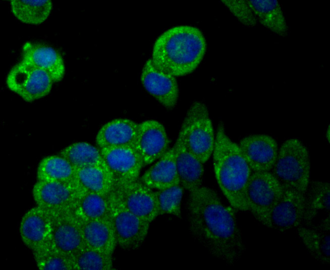 ICC staining iNOS in LOVO cells (green). The nuclear counter stain is DAPI (blue). Cells were fixed in paraformaldehyde, permeabilised with 0.25% Triton X100/PBS.