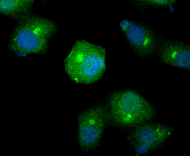 ICC staining Smad4 in A549 cells (green). The nuclear counter stain is DAPI (blue). Cells were fixed in paraformaldehyde, permeabilised with 0.25% Triton X100/PBS.