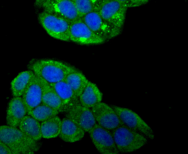 ICC staining Smad4 in Hela cells (green). The nuclear counter stain is DAPI (blue). Cells were fixed in paraformaldehyde, permeabilised with 0.25% Triton X100/PBS.