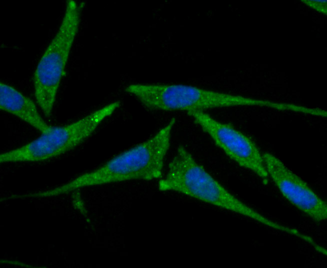 ICC staining Smad4 in SH-SY5Y cells (green). The nuclear counter stain is DAPI (blue). Cells were fixed in paraformaldehyde, permeabilised with 0.25% Triton X100/PBS.