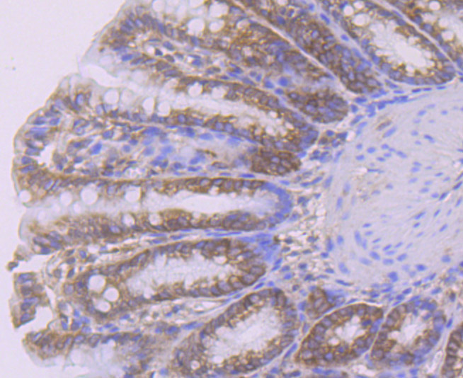 Immunohistochemical analysis of paraffin-embedded rat large intestine tissue using anti-Smad4 antibody. Counter stained with hematoxylin.