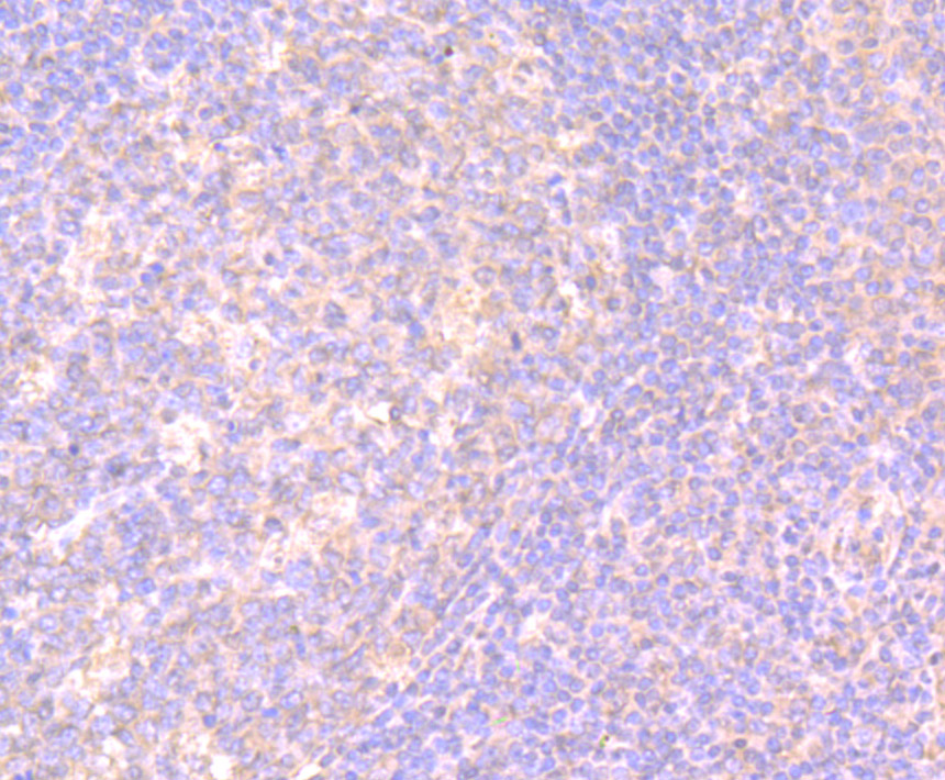 Immunohistochemical analysis of paraffin-embedded human tonsil tissue using anti-IL-17 antibody. Counter stained with hematoxylin.
