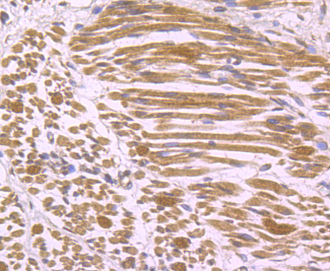 Immunohistochemical analysis of paraffin-embedded human fetal skeletal muscle tissue using anti-IL-17 antibody. Counter stained with hematoxylin.