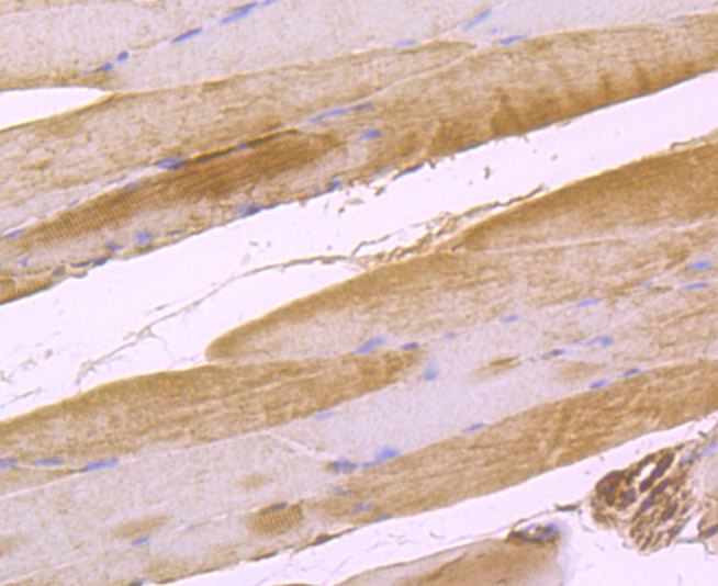 Immunohistochemical analysis of paraffin-embedded rat skeletal muscle tissue using anti-IL-17 antibody. Counter stained with hematoxylin.