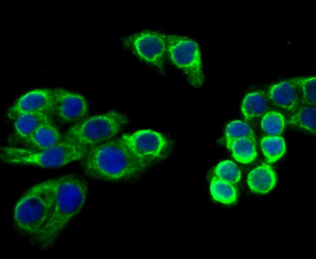 ICC staining Cytokeratin 8 in LOVO cells (green). The nuclear counter stain is DAPI (blue). Cells were fixed in paraformaldehyde, permeabilised with 0.25% Triton X100/PBS.