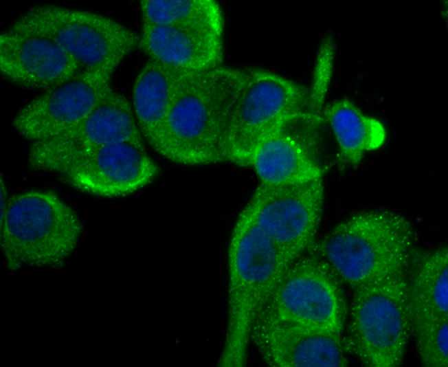 ICC staining Cytokeratin 8 in MCF-7 cells (green). The nuclear counter stain is DAPI (blue). Cells were fixed in paraformaldehyde, permeabilised with 0.25% Triton X100/PBS.