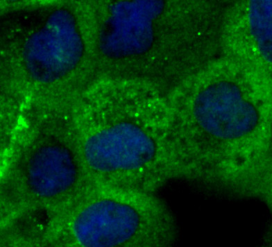 ICC staining SHP2 in A431 cells (green). The nuclear counter stain is DAPI (blue). Cells were fixed in paraformaldehyde, permeabilised with 0.25% Triton X100/PBS.