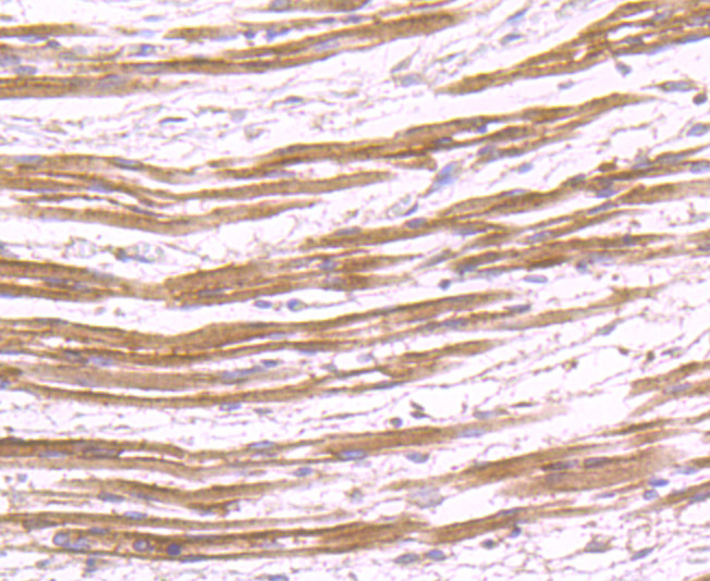 Immunohistochemical analysis of paraffin-embedded human fetal skeletal muscle tissue using anti-SHP2 antibody. Counter stained with hematoxylin.