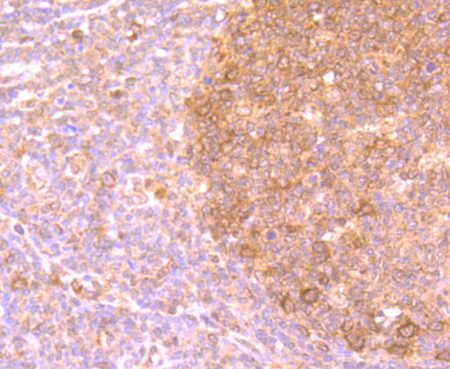 Immunohistochemical analysis of paraffin-embedded human tonsil tissue using anti-PFAS antibody. Counter stained with hematoxylin.