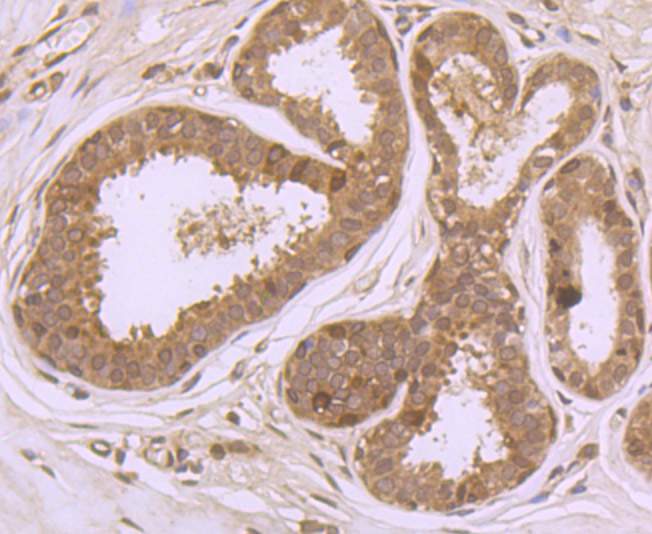 Immunohistochemical analysis of paraffin-embedded human breast tissue using anti-PFAS antibody. Counter stained with hematoxylin.