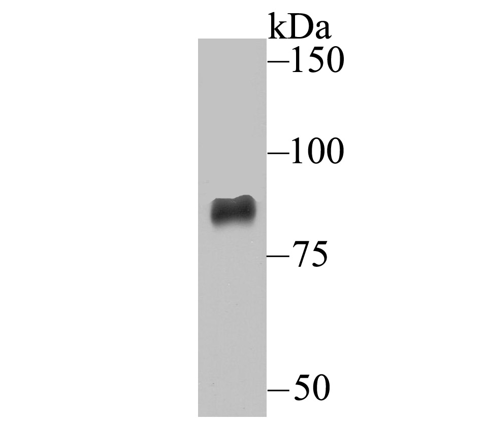 Western blot analysis of ADAM10 on SiHa cell lysate using anti-ADAM10 antibody at 1/5,000 dilution.