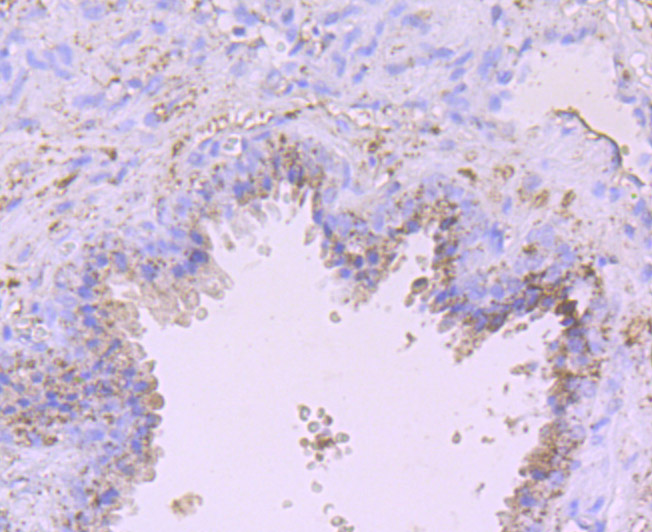 Immunohistochemical analysis of paraffin-embedded human prostate tissue using anti-ADAM10 antibody. Counter stained with hematoxylin.