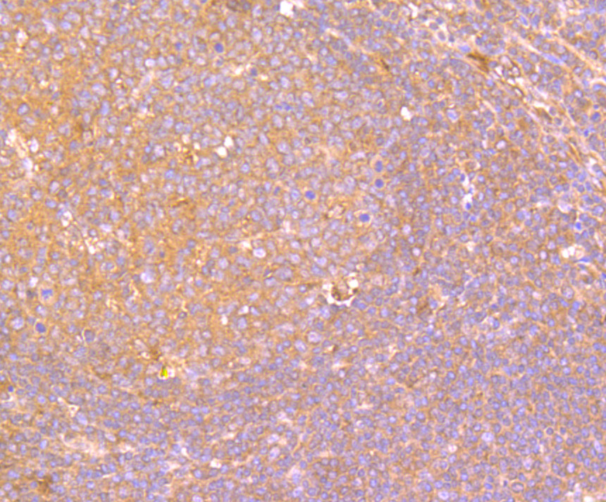 Immunohistochemical analysis of paraffin-embedded human tonsil tissue using anti-IL19 antibody. Counter stained with hematoxylin.