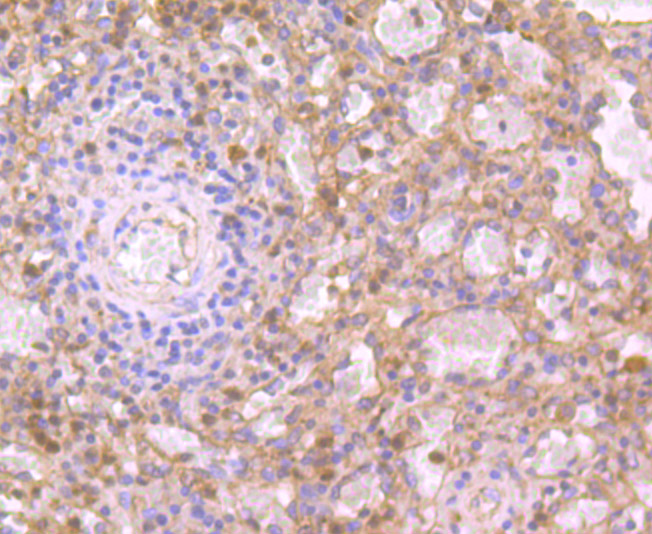 Immunohistochemical analysis of paraffin-embedded human spleen tissue using anti-IL19 antibody. Counter stained with hematoxylin.
