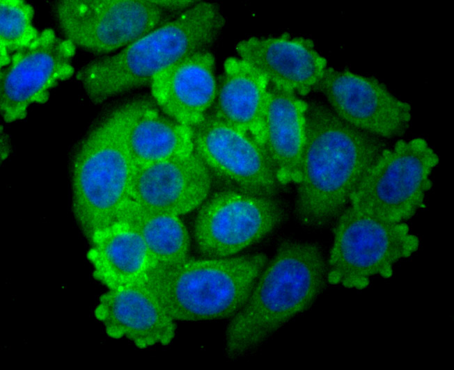 ICC staining PSMA in HepG2 cells (green). The nuclear counter stain is DAPI (blue). Cells were fixed in paraformaldehyde, permeabilised with 0.25% Triton X100/PBS.