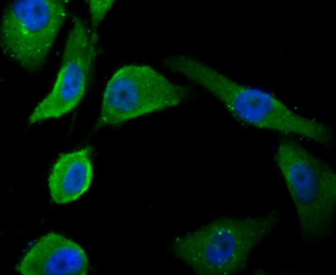 ICC staining PSMA in PC-3M cells (green). The nuclear counter stain is DAPI (blue). Cells were fixed in paraformaldehyde, permeabilised with 0.25% Triton X100/PBS.