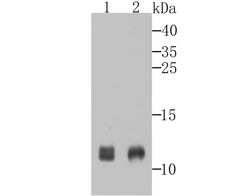 Western blot analysis of PBR on A431 and PC-3M cell lysateS using anti-PBR antibody at 1/500 dilution.