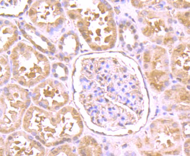 Immunohistochemical analysis of paraffin-embedded human kidney tissue using anti-PBR antibody. Counter stained with hematoxylin.