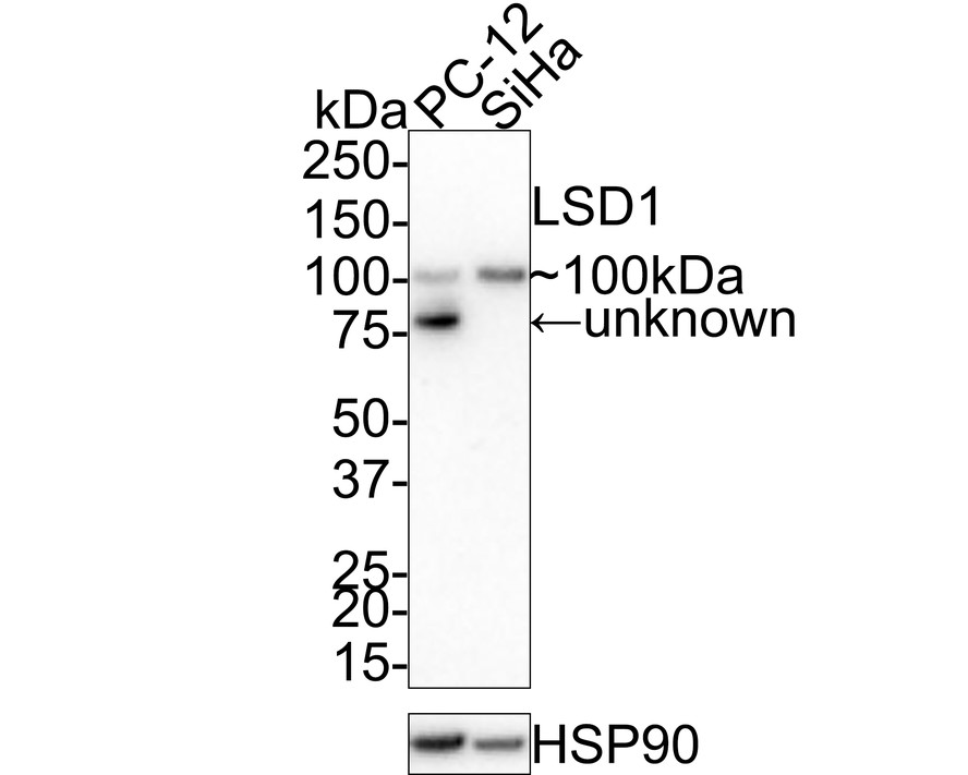 LSD1 Rabbit Polyclonal Antibody (ER1802-12) – HUABIO