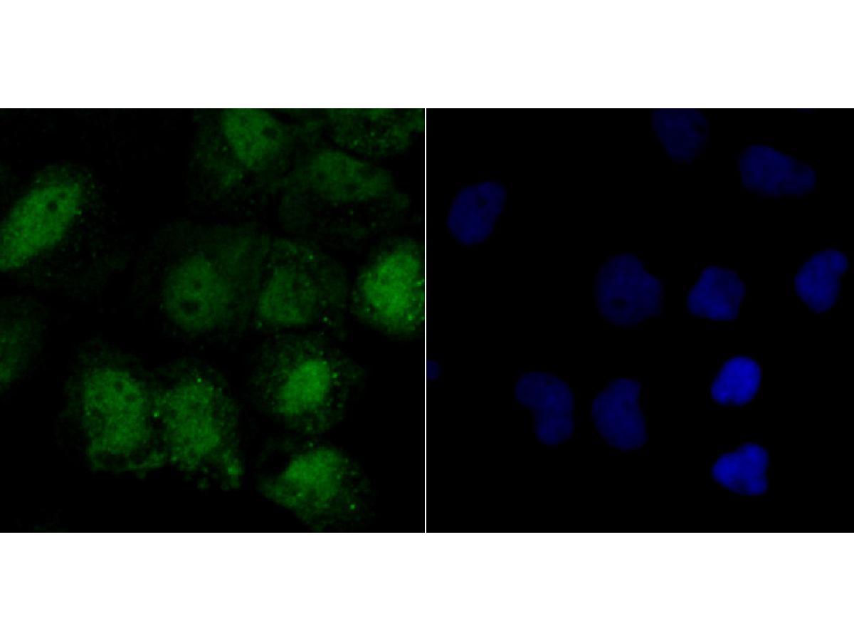 ICC staining LSD1 in A431 cells (green). The nuclear counter stain is DAPI (blue). Cells were fixed in paraformaldehyde, permeabilised with 0.25% Triton X100/PBS.