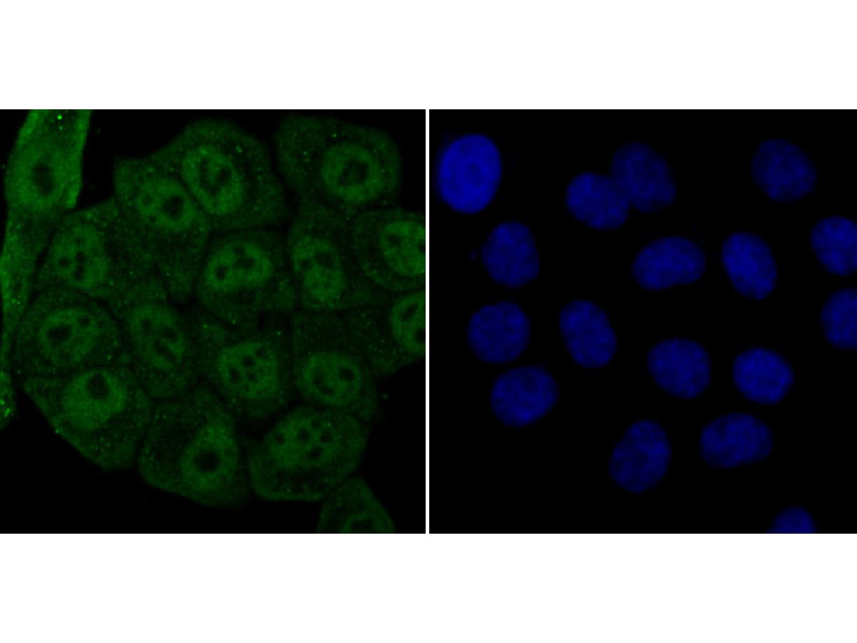 ICC staining LSD1 in HepG2 cells (green). The nuclear counter stain is DAPI (blue). Cells were fixed in paraformaldehyde, permeabilised with 0.25% Triton X100/PBS.