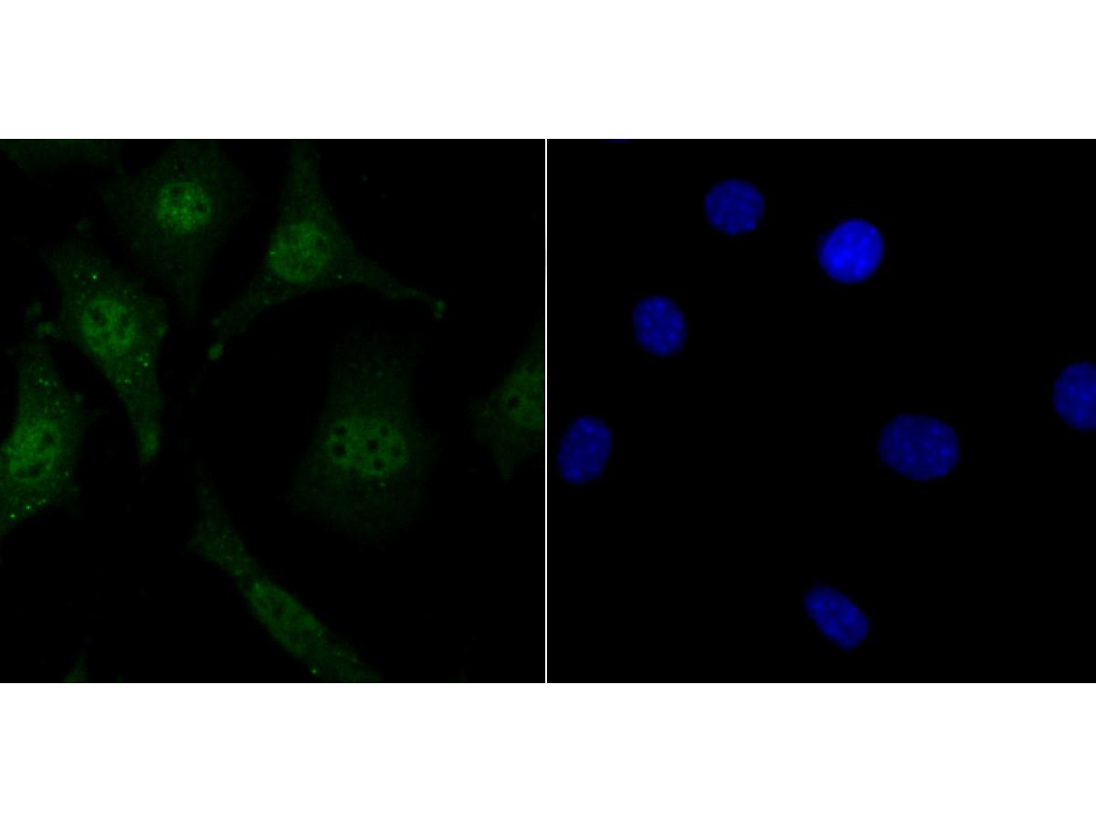 ICC staining LSD1 in SH-SY-5Y cells (green). The nuclear counter stain is DAPI (blue). Cells were fixed in paraformaldehyde, permeabilised with 0.25% Triton X100/PBS.