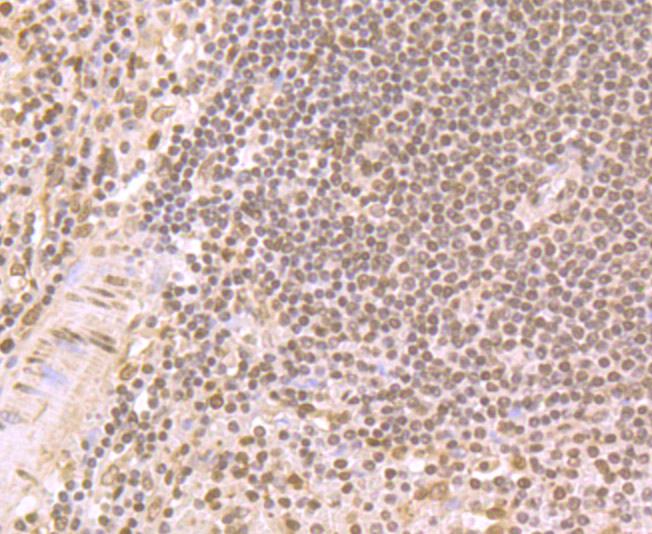 LSD1 Rabbit Polyclonal Antibody (ER1802-12) – HUABIO