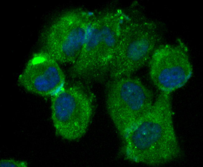 ICC staining beta Arrestin 1 in HUVEC cells (green). The nuclear counter stain is DAPI (blue). Cells were fixed in paraformaldehyde, permeabilised with 0.25% Triton X100/PBS.