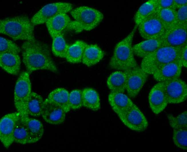 ICC staining beta Arrestin 1 in LOVO cells (green). The nuclear counter stain is DAPI (blue). Cells were fixed in paraformaldehyde, permeabilised with 0.25% Triton X100/PBS.