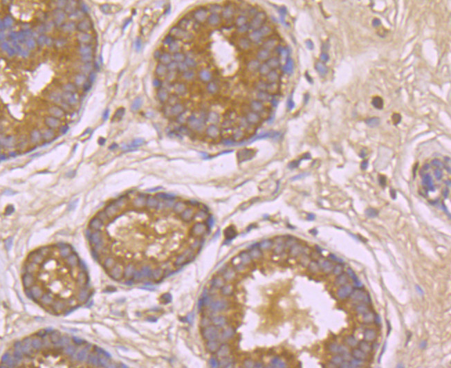 Immunohistochemical analysis of paraffin-embedded human breast tissue using anti-beta Arrestin 1 antibody. Counter stained with hematoxylin.