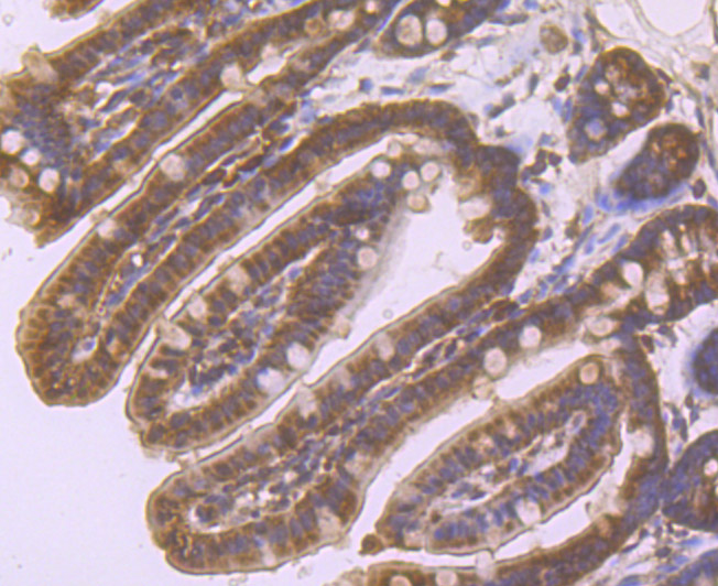 Immunohistochemical analysis of paraffin-embedded mouse colon tissue using anti-beta Arrestin 1 antibody. Counter stained with hematoxylin.
