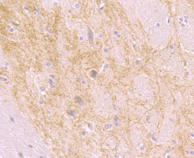 Immunohistochemical analysis of paraffin-embedded rat brain tissue using anti-beta Arrestin 1 antibody. Counter stained with hematoxylin.