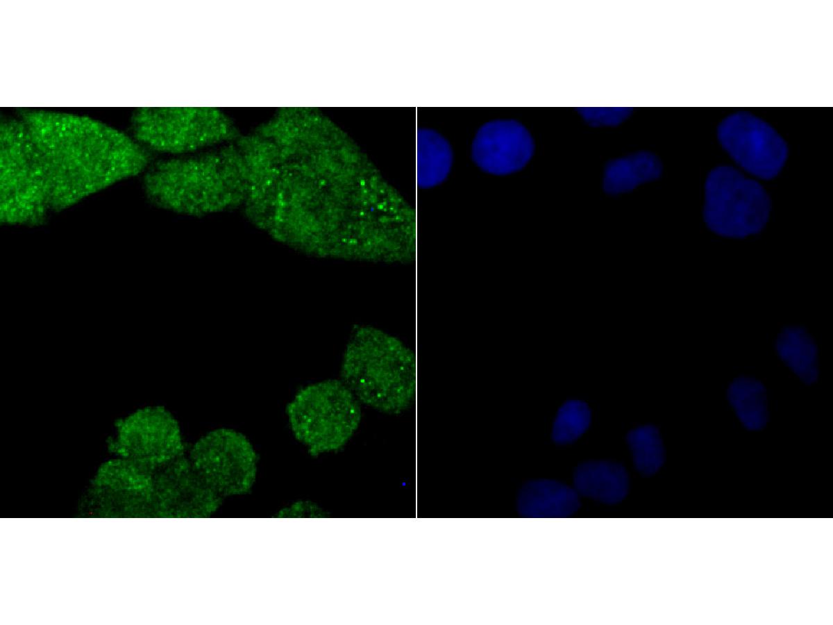 ICC staining PKC beta 2 in Hela cells (green). The nuclear counter stain is DAPI (blue). Cells were fixed in paraformaldehyde, permeabilised with 0.25% Triton X100/PBS.