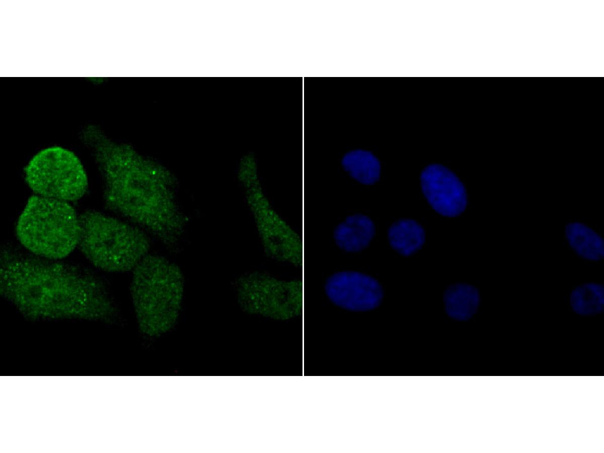 ICC staining PKC beta 2 in HepG2 cells (green). The nuclear counter stain is DAPI (blue). Cells were fixed in paraformaldehyde, permeabilised with 0.25% Triton X100/PBS.