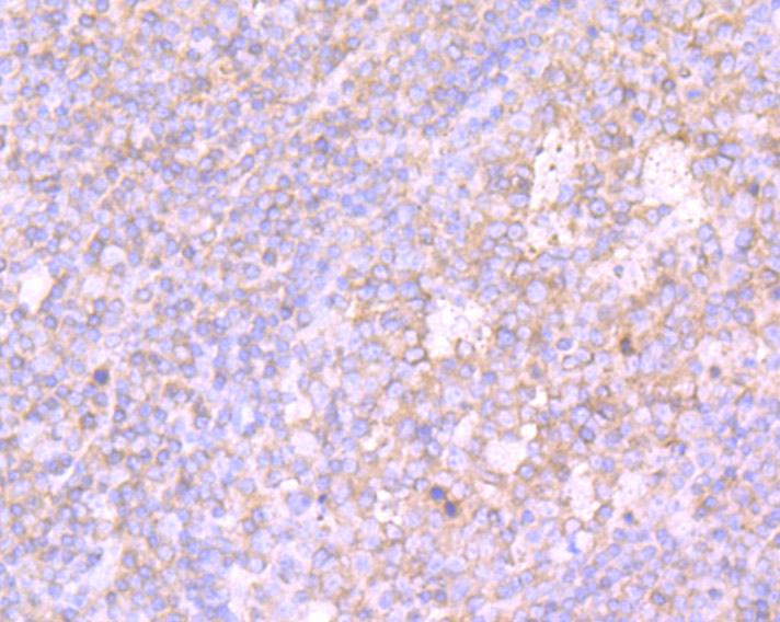 Immunohistochemical analysis of paraffin-embedded human tonsil tissue using anti-PKC beta 2 antibody. Counter stained with hematoxylin.
