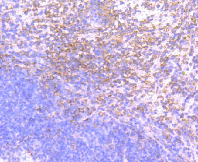 Immunohistochemical analysis of paraffin-embedded mouse spleen tissue using anti-PKC beta 2 antibody. Counter stained with hematoxylin.
