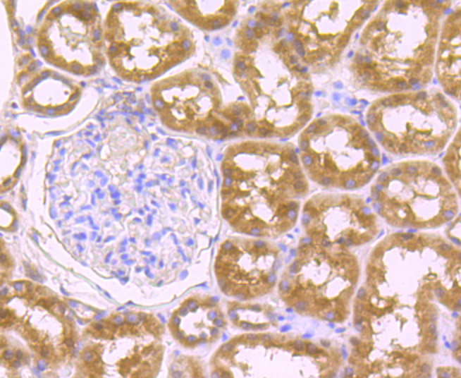 Immunohistochemical analysis of paraffin-embedded human kidney tissue using anti-Osteopontin antibody. Counter stained with hematoxylin.
