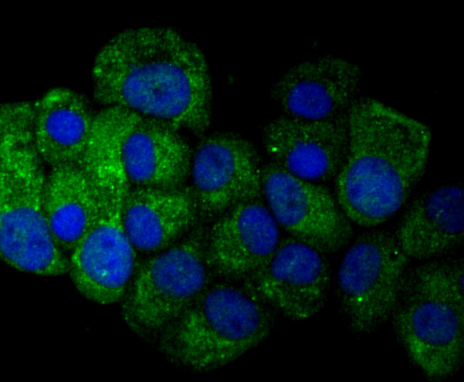 ICC staining Osteopontin in MCF-7 cells (green). The nuclear counter stain is DAPI (blue). Cells were fixed in paraformaldehyde, permeabilised with 0.25% Triton X100/PBS.