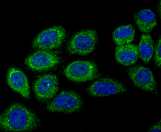 ICC staining DOCK4 in HepG2 cells (green). The nuclear counter stain is DAPI (blue). Cells were fixed in paraformaldehyde, permeabilised with 0.25% Triton X100/PBS.