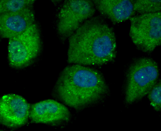ICC staining DOCK4 in HUVEC cells (green). The nuclear counter stain is DAPI (blue). Cells were fixed in paraformaldehyde, permeabilised with 0.25% Triton X100/PBS.
