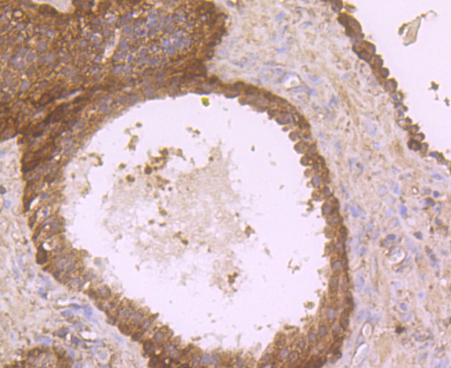Immunohistochemical analysis of paraffin-embedded human prostate tissue using anti-DOCK4 antibody. Counter stained with hematoxylin.