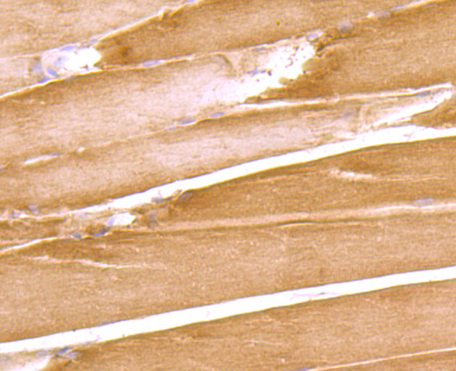 Immunohistochemical analysis of paraffin-embedded rat skeletal muscle tissue using anti-DOCK4 antibody. Counter stained with hematoxylin.
