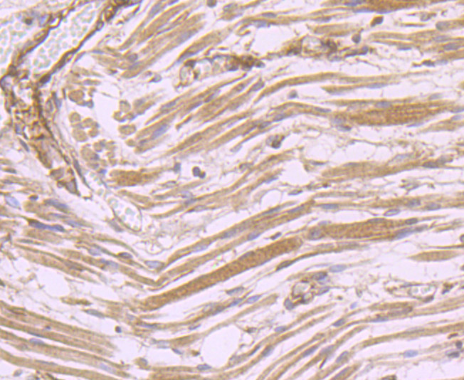 Immunohistochemical analysis of paraffin-embedded human fetal skeletal muscle tissue using anti-DOCK4 antibody. Counter stained with hematoxylin.