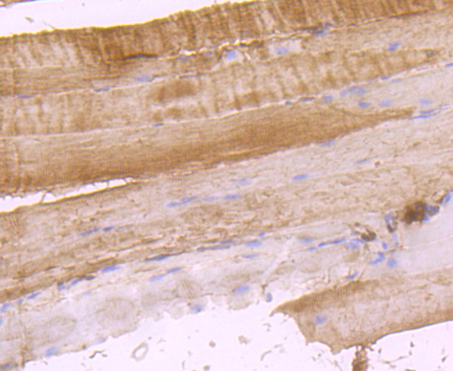 Immunohistochemical analysis of paraffin-embedded mouse skeletal muscle tissue using anti-DOCK4 antibody. Counter stained with hematoxylin.